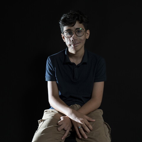 Boy wearing glasses, a navy blue polo shirt, and beige pants sitting against a black background. His hands are crossed in his lap. His face is scarred; his right hand is injured and missing fingers.