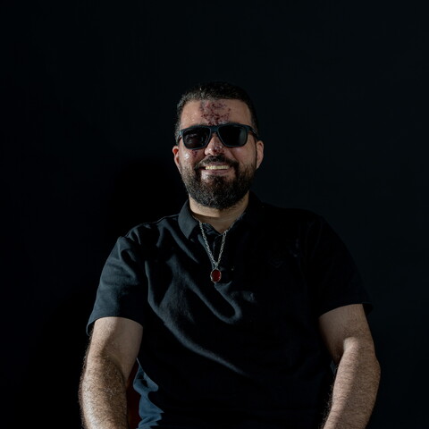 A photo of a smiling man in front of a black background. He is bearded, wearing black, and wearing sunglasses. There are scars on his face.