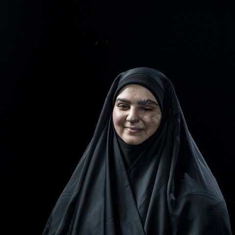امرأة مبتسمة ترتدي حجاباً أسود وتجلس أمام خلفية سوداء. على وجهها ويديها ندوب واضحة.