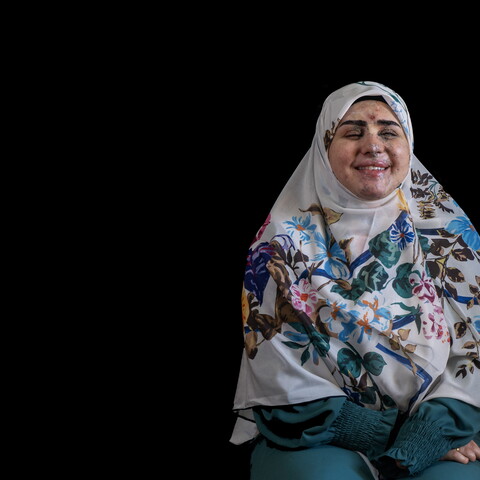 A medium studio portrait of a woman, Rawan al-Moussawi, seated against a solid black background. She is wearing a white hijab patterned with vibrant blue, purple, and orange flowers, along with a dark green long-sleeved dress. She is smiling warmly with her eyes closed. Visible scarring and healing shrapnel injuries are present across her face, particularly on her forehead, nose, and cheeks.
