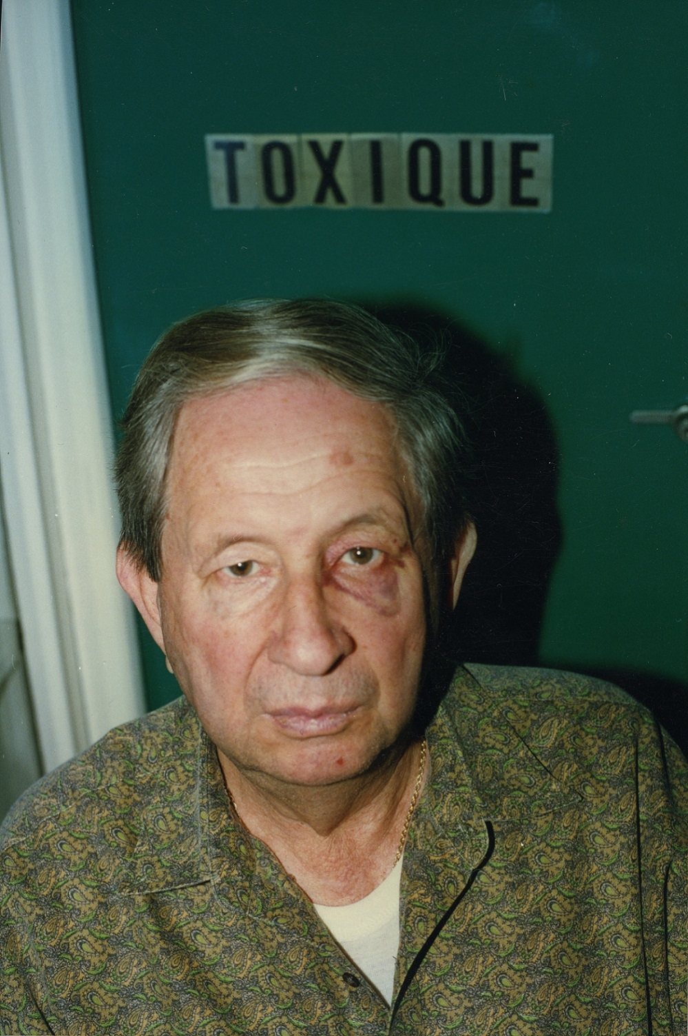 A portrait of a man with a bruised and blackened eye standing in front of a door that reads: "TOXIQUE"