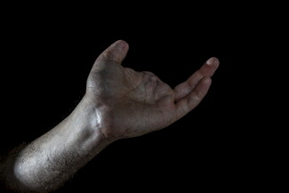 A hand and forearm held palm up against a black background, fingers slightly curled and thumb extended. The index and middle fingers, and thumbtip, are missing.