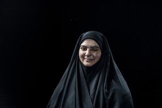 امرأة مبتسمة ترتدي حجاباً أسود وتجلس أمام خلفية سوداء. على وجهها ويديها ندوب واضحة.