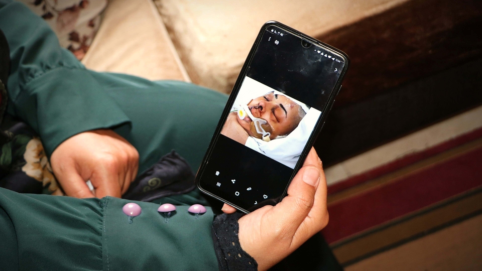 Close-up of Fatima's arms as she holds her phone displaying a photo of her in a hospital bed, on a ventilator, with a bruised eye and stitches under her nose.